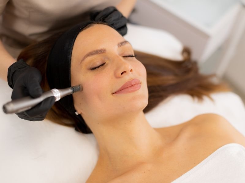 Skin Master 4D Microneedling Avanzado